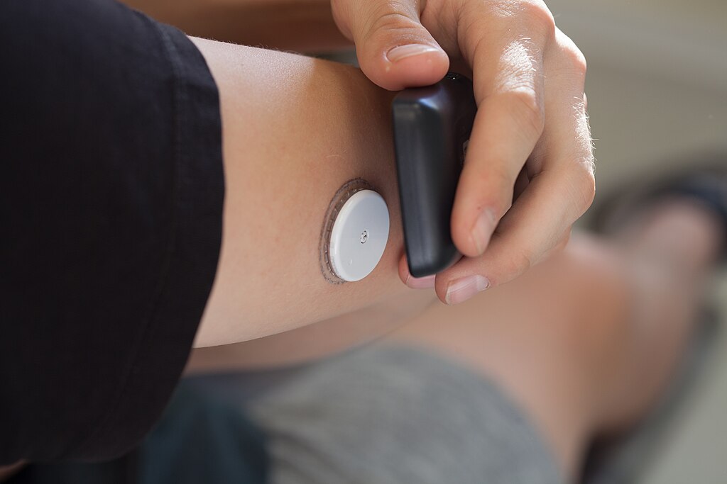 A FreeStyle Libre continuous glucose monitor sensor worn on the back of an upper arm, with a handheld reader nearby.